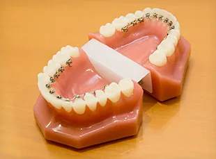 目立ちにくい矯正装置を取り揃えています