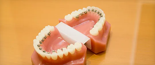 目立ちにくい矯正装置を取り揃えています
